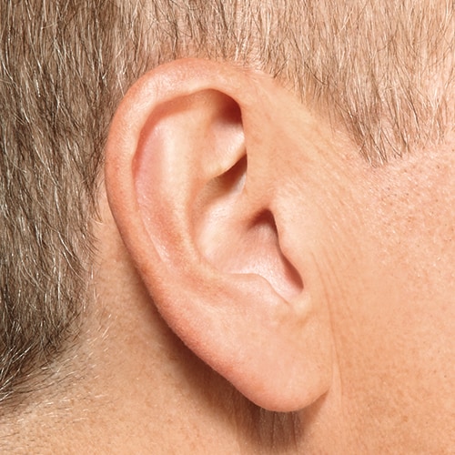 Invisible-in-canal hearing aids